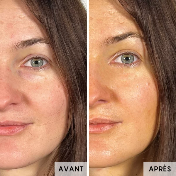 Concentré D’églantier - booster de collagène – Image 3